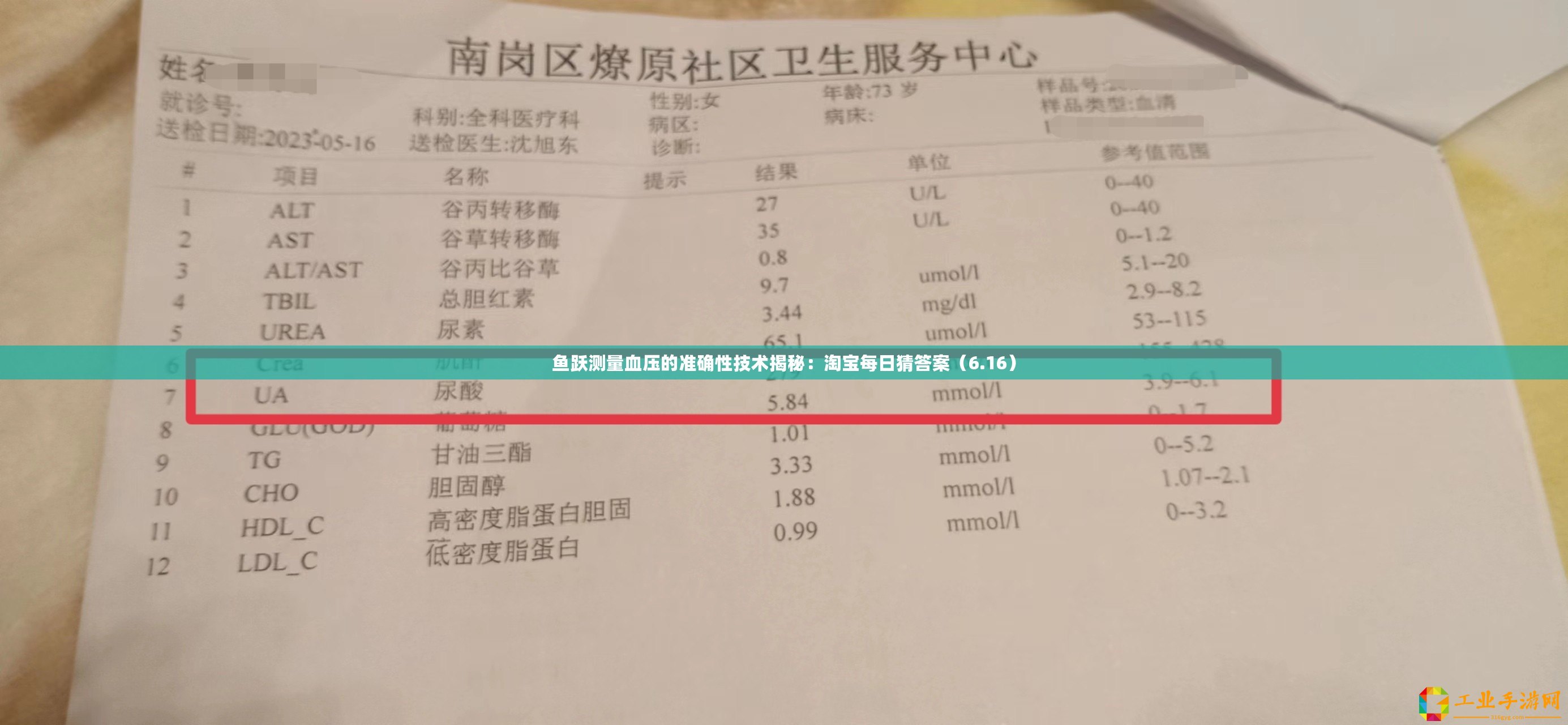 魚躍測量血壓的準(zhǔn)確性技術(shù)揭秘：淘寶每日猜答案（6.16）